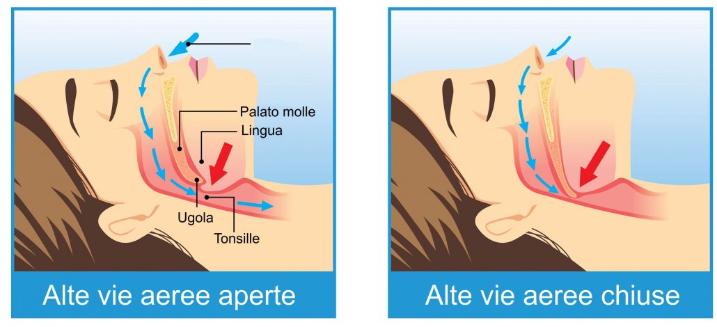 Russare: Ecco la meccanica del russamento